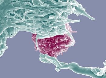 Foto-foto hasil scanning mikroskop elektron 10