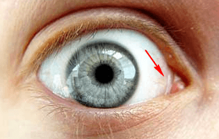 10 sisa organ yang tak berguna pada manusia 2