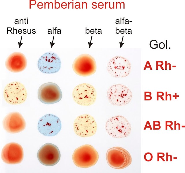 Praktikum golongan darah ABO dan Rhesus